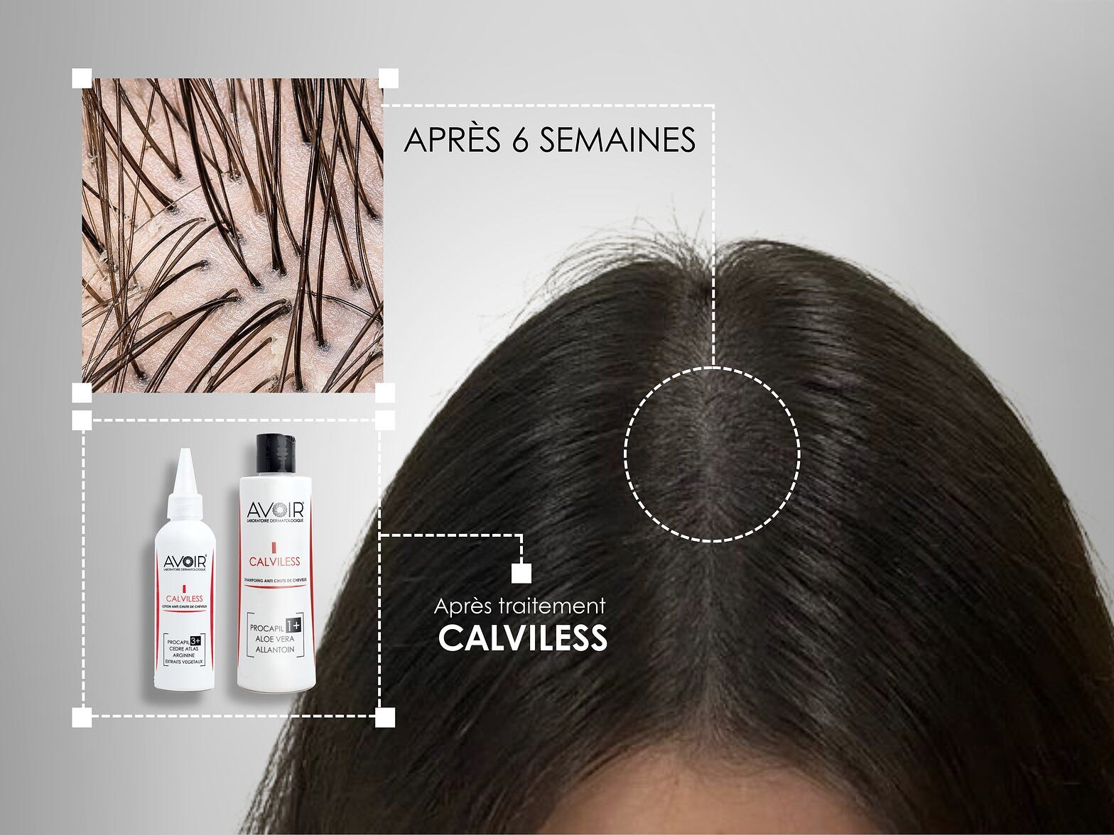 Observation du cuir chevelu — séance de suivi